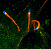 Microbe-based therapies: cyclic dinucleotides, Listeria